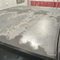 رفع افتاب سوختگی با ماندگاری پنج سال بدون رنگ