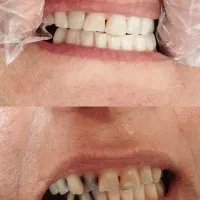 خدمات دندانپزشکی ترمیمی زیبایی