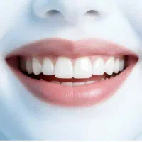 عصب کشی ۱.۵۰۰  کامپوزیت ۷۰۰ فقط ۳ روز و اقساط