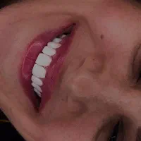 دندانپزشکی با ضمانت نامه کتبی ۱۰ ساله
