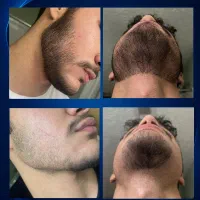 تضمینی چهرتو مردونه کن