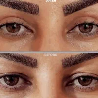 اپیلاسیون ولیزر،جراحی و زیبایی صورت و بدن