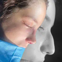 جراحی زیبایی/اقساطی/بدون سود