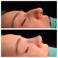 کلیه ی خدمات عمل های زیبایی نقد و اقساط در تهران