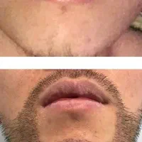 پرپشتی ریشات مهم ترین چیزه
