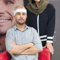 کاشت مو اقساطی ونقد