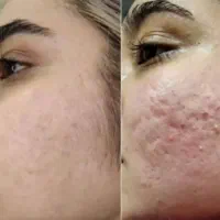 چرا تزریق‌ با محصولات ما شو همون چیزی که می خواهی