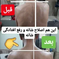 اصلاحی درمانی. رگگیری. زالودرمانی. حجامت