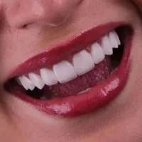 ارتودنسی بدون چک