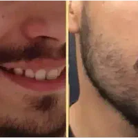 با ما تضمینی ریش دار شو