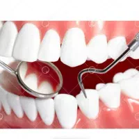 ایمپلنت لمینت کامپوزیت عصبکشی دندانپزشکی کلینیک دی