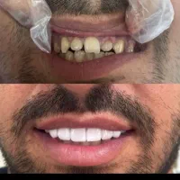 آموزش کامل دندانپزشکی .زیبایی ودرمانی .اقساطی