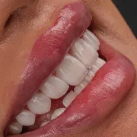 خدمات دندانپزشکی اقساطی و بیمه