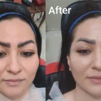 پاکسازی و روشن کننده