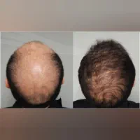 امروز، شروع یک تغییر قشنگه