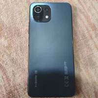 گوشیmi 11 lite