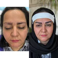 کاشت ابرو به خواب کاملا طبیعی
