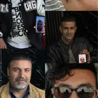 کاشت مو و ابرو با شرایط قسطی
