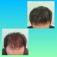 رقیب کاشت
