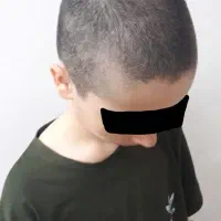 خرید موی طبیعی آقایان و کودکان با هر قد و اندازه