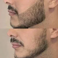 افزایش سرعت. ر‌شد.25روزه