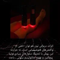 فروش دستگاه درمالوکس نور تراپی