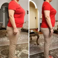 موثرین روش لاغری با یک جلسه هدیه با کرایولیپولیز