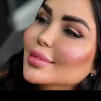 تزریق ژل لب .چانه.کات گونه.خط خنده