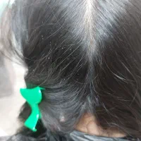 پاکسازی مو از شپش و رشک