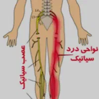 مرکز تخصصی ماساژ و حجامت در سنندج
