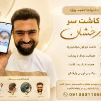 تخفیف ویژه کاشت مو فول تراکم