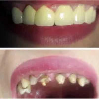 دندانپزشکی و دندان سازی خیریه چمران (جراحی. زیبایی
