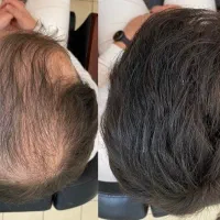 موهات داره کم پشت میشه پیام بده