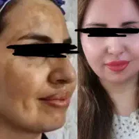 دارای تاییدیه کرمسازی