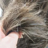 آف ویژه موخوره‌گیری