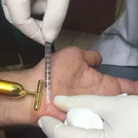 جشنواره اموزش تخفیفات فیلر وژل وبوتاکس ومزو تراپی