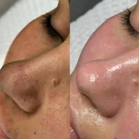 فیشیال تخصصی آقایان وبانوان زیر نظر پزشک