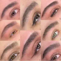 میکروبلیدینگ‌ و میکروپیگمنتیشن