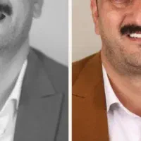 ایمپلنت