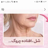 رفع چروک وخط لبخندوافتادگی صورت