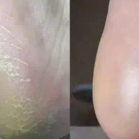 جویای کار دستیاری پدیکور    و کراتین  فوری