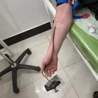 انجام فصد خون در منزل