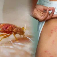 سمپاشی تخصصی ساس و سوسک سم پاشی با ضمانت ۲ ساله