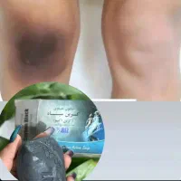 صابون کربن سیاه