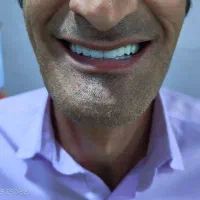 دندانسازی