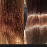 موخوره گیری و هیدروژن تراپی