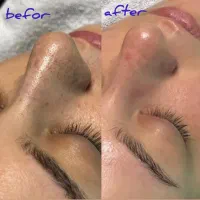 مرکز تخصصی مراقبت پوست و فشیال ماریسا